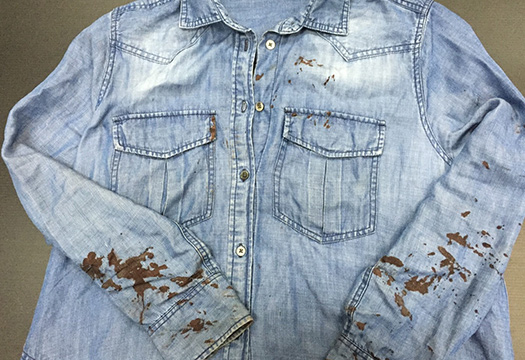 血シミ after